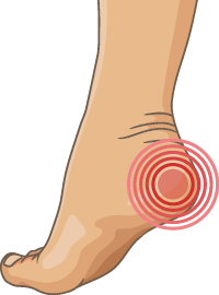 Angela Sanders Podiatry Heel pain Treatment Angela Sanders Podiatry Heel pain Treatment